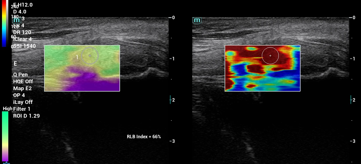 placeholder image-sq