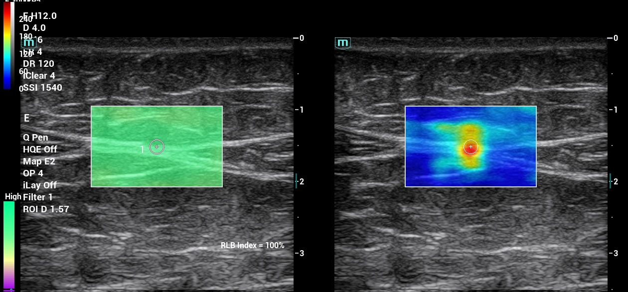 placeholder image-sq