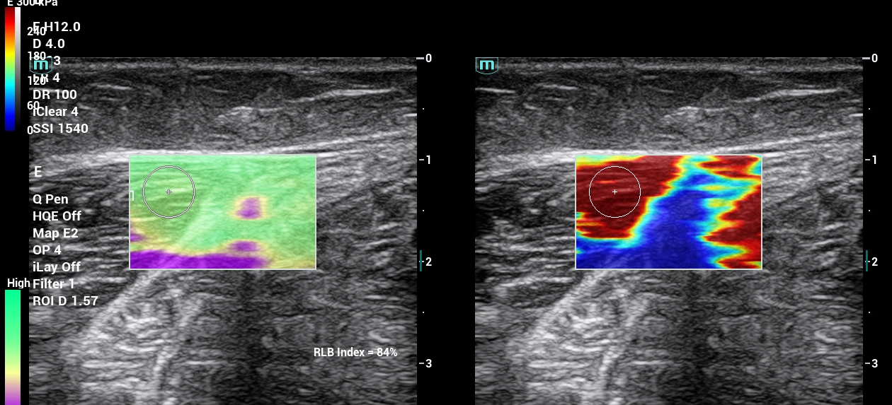 placeholder image-sq